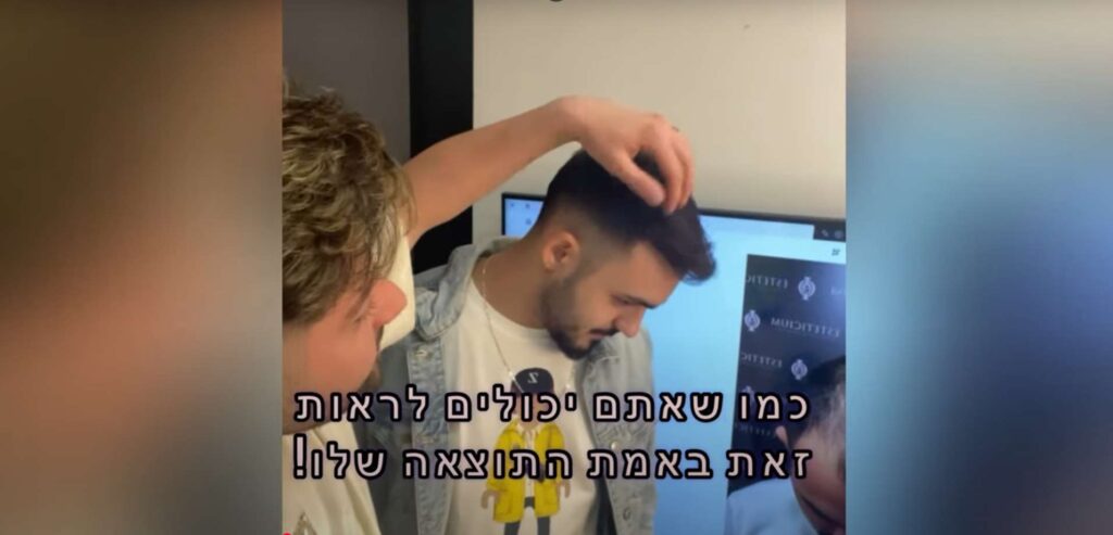 השתלת שיער גברים