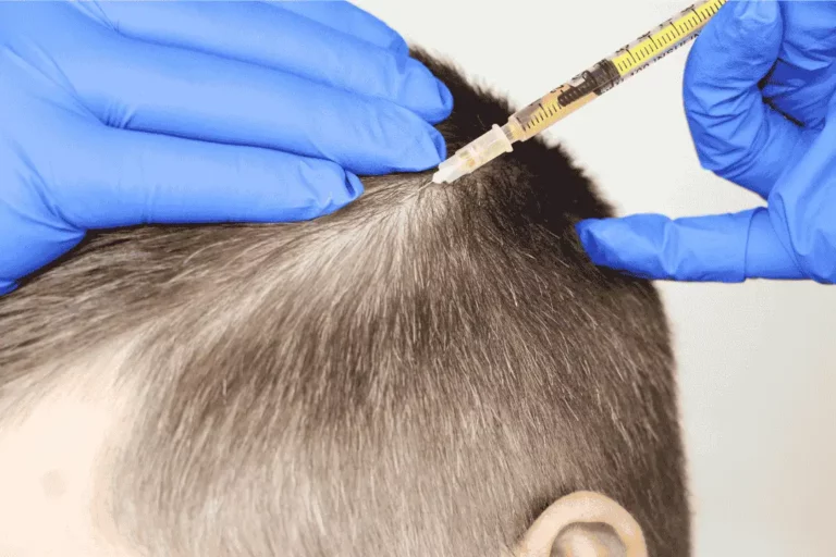 טיפול פלזמה מחיר