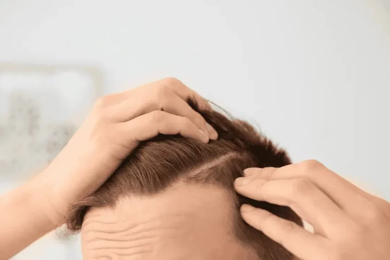 איך יודעים שההשתלה נקלטה